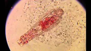 Rotifer Feeding 01