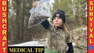 Emergency Survival Tip In The Woods | Bushcraft Medical Skill | NATURAL MEDICINE