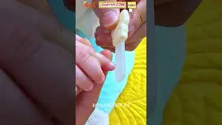 Baby Nail Care Kit: The Safest Way to Trim Baby&rsquo;s Nails #ParentingTips