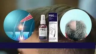 FEG Plus Hair Growth Spray In Pakistan | Shop Now Online | FegPlus.pk