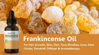 Essancia - Frankincense Essential Oil For Hair Growth, Skin, Hair, Face Wrinkles