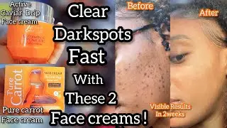 The ULTIMATE Routine for Dark Spots | Doctorly Hypermentation and Melasma Guide 