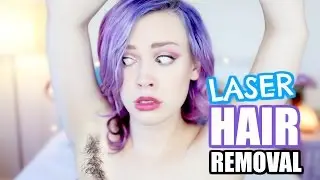 LASER HAIR REMOVAL Before & After 4 months | Laseraway
