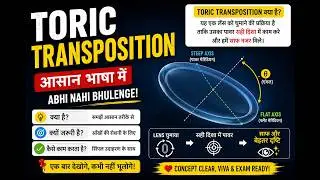 TRANSPOSITION-TORIC TRANSPOSITION PART 2 IN HINDI