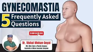 Gynecomastia के बारे में 5 सवाल? यह क्यों होता है, इसका इलाज क्या है? Dr. Vishal Mohan Goyal