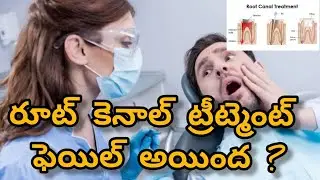 Root Canal Treatment failure reasons || రూట్ కెనాల్ ట్రీట్మెంట్ ఫెయిల్ అయింద?