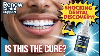 🔥 FIX Your Teeth Fast in 10 Seconds with Renew Dental Support! 🦷💥 | Must See Results!