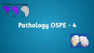 Pathology OSPE 4 | Amyloidosis #pathology