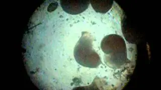 Young whelks (Busycon ) from egg case that was hung up
