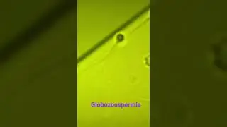 #globozoospermia #icsi #ivf #ivflab #embryologist #bestivfcentreinindia #azoospermia #sperm