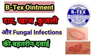 B-Tex Ointment Uses In Hindi || बी टेक्स मलहम के फायदे ||Skin Infection Solution