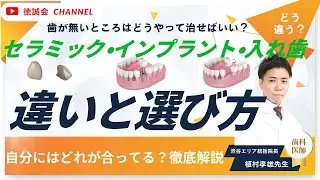歯を失ったら何が正解？インプラント・入れ歯・ブリッジを歯科医師が比較