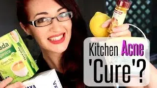 KITCHEN ACNE CURES?! DIY Natural Acne & Scarring Treatments At Home!
