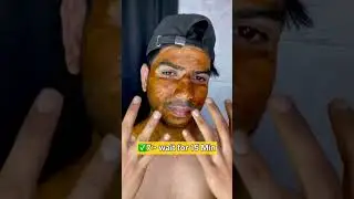 Day 11/90, Remove Tanning from Face in 10 Days | Suntan Removal Home Remedy