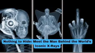 Nothing to Hide: Meet the Man Behind the World&rsquo;s Iconic X-Rays