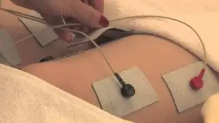 Ionto Lift Cellulite