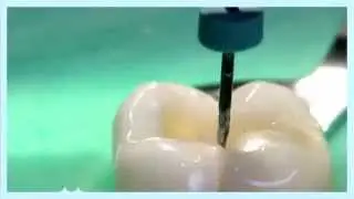 One Shape