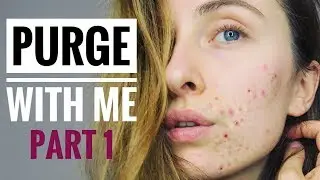 Salicylic Acid Purge WEEK BY WEEK | Decongest Skin