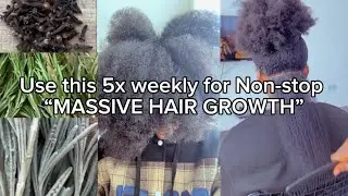 How to make Rosemary, Lavender & Cloves water for MASSIVE HAIR GROWTH 😱| Your Favourite Hair Coach