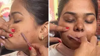 Facial hair/चेहरे के बाल kaise hataye /Facial Hair Razer Kaise Use Kare /चेहरे के बाल कैसे साफ़ करे 