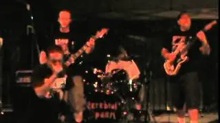 Cerebral Spasm playing 