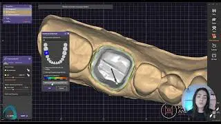 Mastering exocad 01 Fundamentals   Institute of Digital Dentistry 5