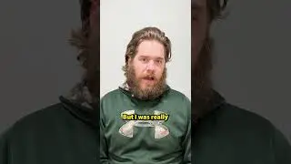 Before And After Crown Hair Transplant Results