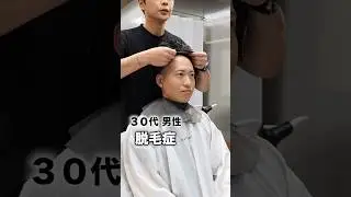 彼の人生初のカツラがカッコ良すぎた。#ウィッグ #脱毛症 #かつら #wig #alopecia #가발 #탈모