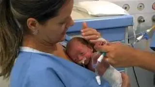 Método Canguru no Brasil