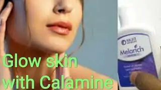 Calamine Lotion | Melarich Lotion |Lacto Calamine | Benefits of Calamine lotion