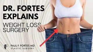 What Happens After Major Weight Loss? | Dr. Fortes Explains Body Contouring Surgery