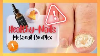 Unlock Beautiful Nails with Metanail Complex! Must Watch for Healthy Nail Secrets! Metanail reviews