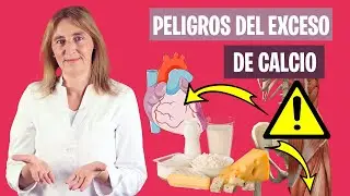 Los PELIGROS de los SUPLEMENTOS de CALCIO | Riesgos del exceso de calcio | Nutrición y Dietética