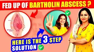 Bartholin Abscess Treatment Without Surgery | Ayurvedic Treatment for Bartholin Abscess and Cyst