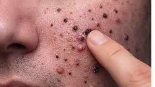 ASMR scrub facial 2026 