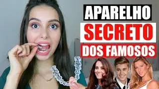 Meu aparelho invisível - Invisalign | Stephanie Garcia