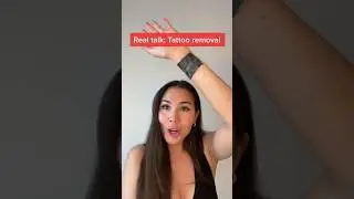 Real talk: my tattoo removal experience in Montreal, Canada #tattoo #shorts