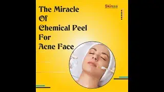 How Will Chemical Peel For Acne Face Be In The Future. #chemical_peeling #acne  #skinaaclinic