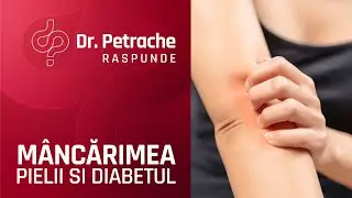 MA MANANCA PIELEA DE LA DIABET?