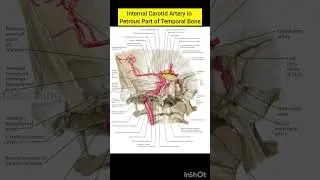Internal Carotid Artery in Petrous Part of Temporal Bone | Cerebral Vasculature | human anatomy 