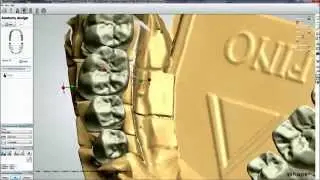 Smile Composer - Zahntechnik Fritsch