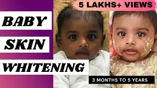 Baby skin whitening tips | How to make baby skin fair naturally at home? | Women central in Tamil