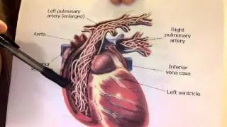 ALS 2304 Disease Presentation - Feline Heartworm Disease
