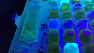 How to Read a Quanti-Tray for E. coli