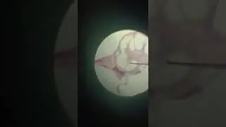 Гистология Спиральный орган