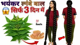 💯Neem Hairgrowth Serum for Superfast Hairgrowth/कसम से बस एक बार लगा कर देखो/Baal bdhane k tarika