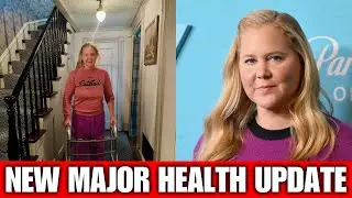 Amy Schumer Reveals Recovery Details After Back Surgery