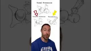 How to Squat For Your Anatomy (Toe Angle!)