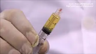 Good morning Bio PRO PRP kit 10cc manual