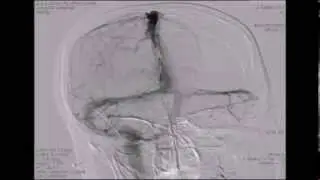 Beh&ccedil;et's Disease 2/2